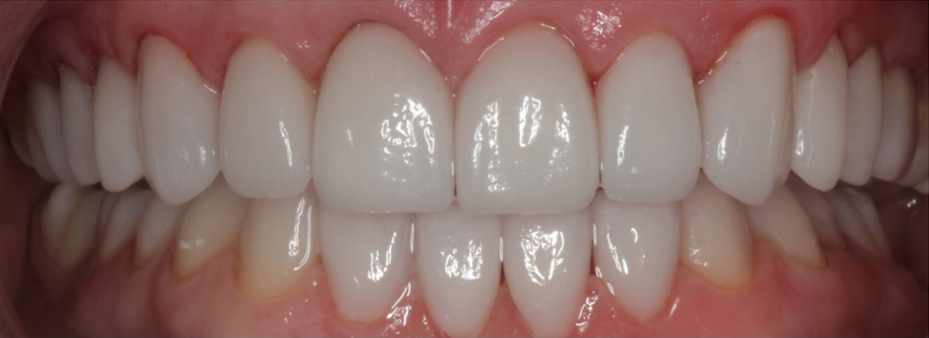 After image