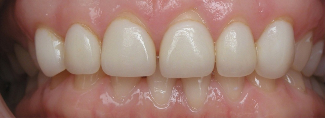 Before image