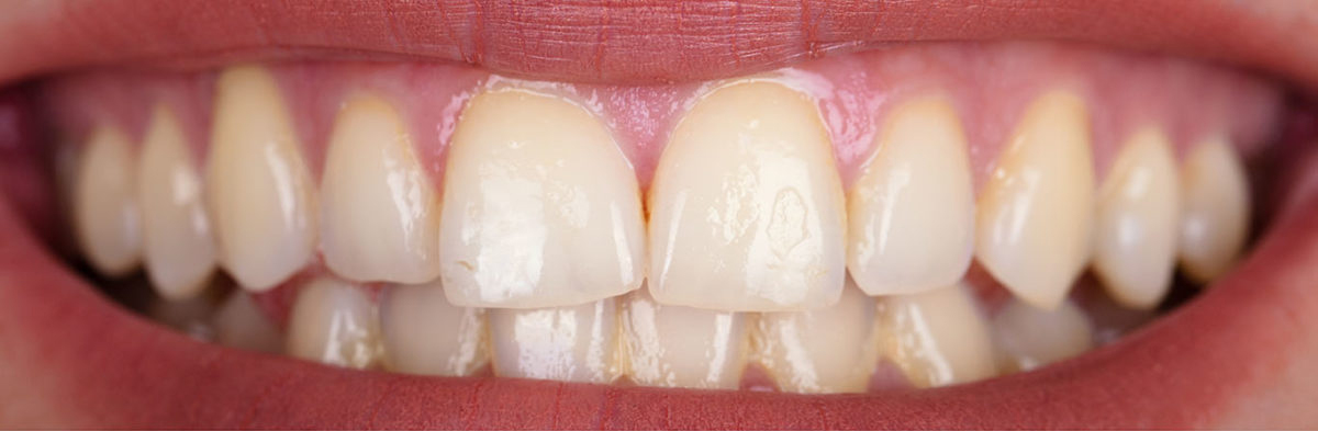 Before image